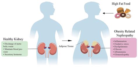 fixx how does obesity affect the kidneys